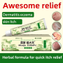 chinese-herbal-skin-psoriasis-cream-dermatitis-eczema-small-0