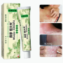 chinese-herbal-skin-psoriasis-cream-dermatitis-eczema-small-4