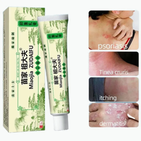 chinese-herbal-skin-psoriasis-cream-dermatitis-eczema-big-4