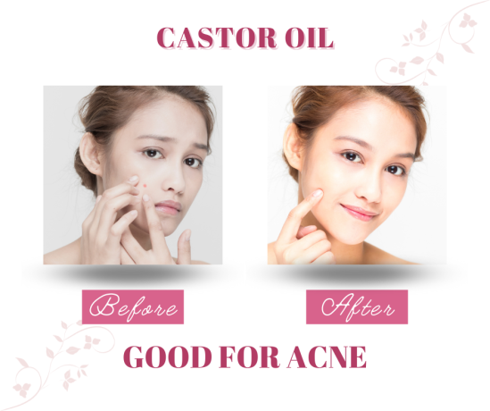 organic-castor-oil-serum-for-skin-care-big-5
